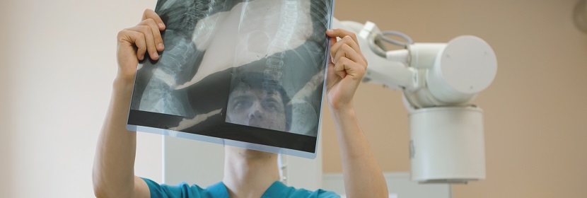 移動CR放射衛(wèi)生檢測評價