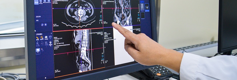 X射線計算機體層攝影(CT)裝置放射衛(wèi)生檢測評價